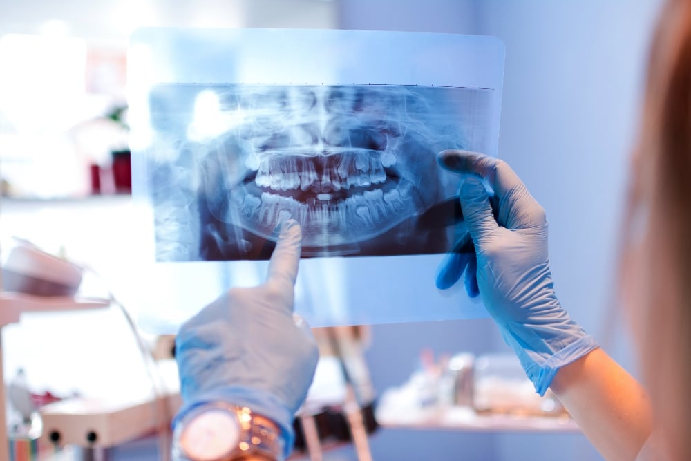 Dental xray